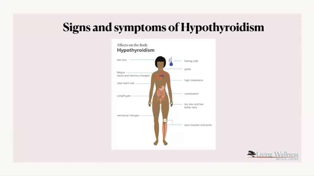Hypothyroidism signs and symptoms