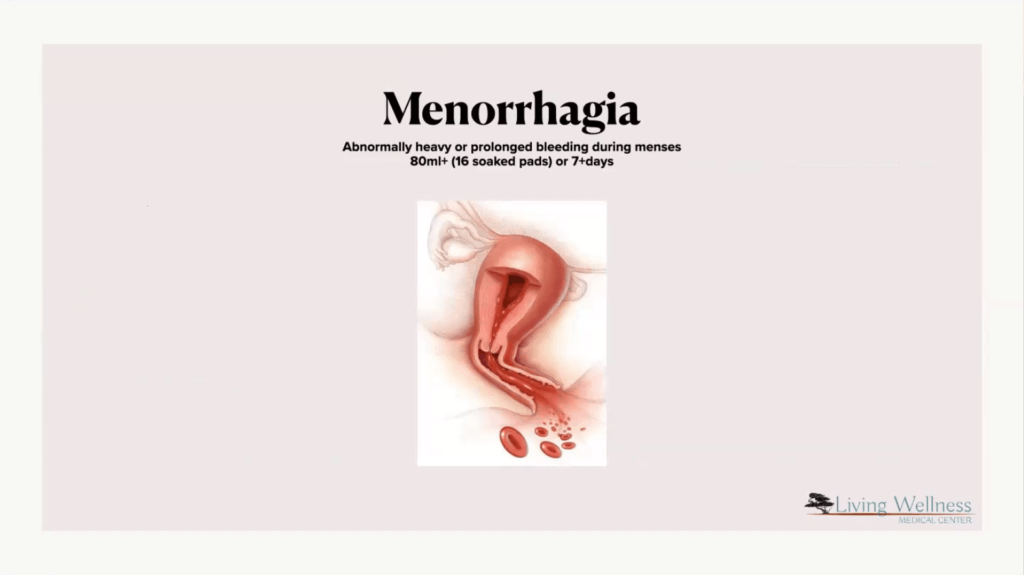 Description of menorrhagia